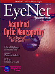 July 2014 EyeNet Cover