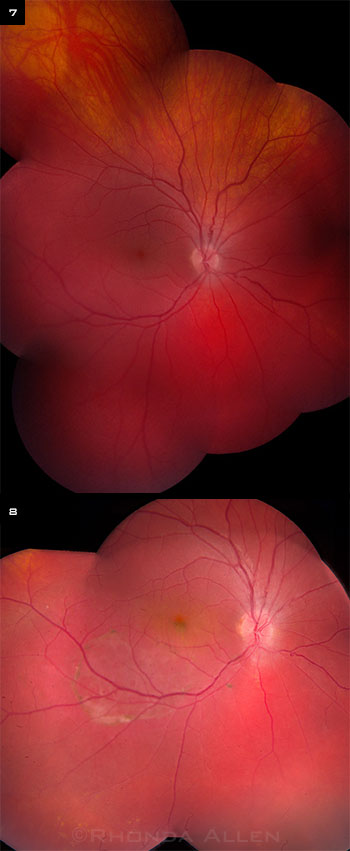 Additional Fundus Images