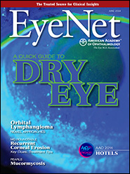 June 2014 EyeNet Cover