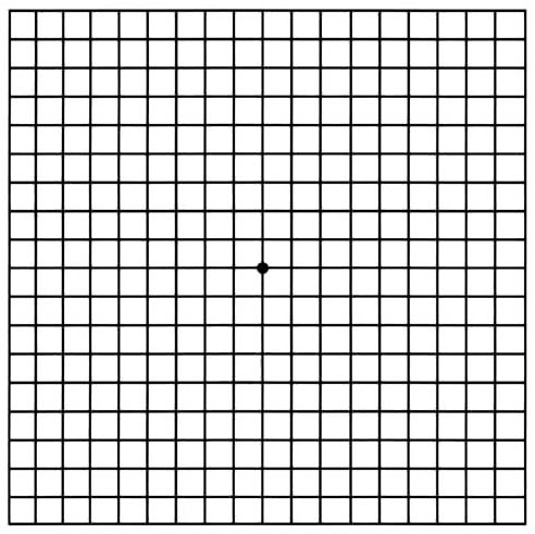 Amsler Grid, used at home daily to track vision changes in people with some eye conditions like AMD or toxoplasmosis