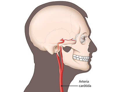 Vista lateral de una arteria carótida, que son los principales vasos sanguíneos del cuello que envían sangre a los ojos y al cerebro.