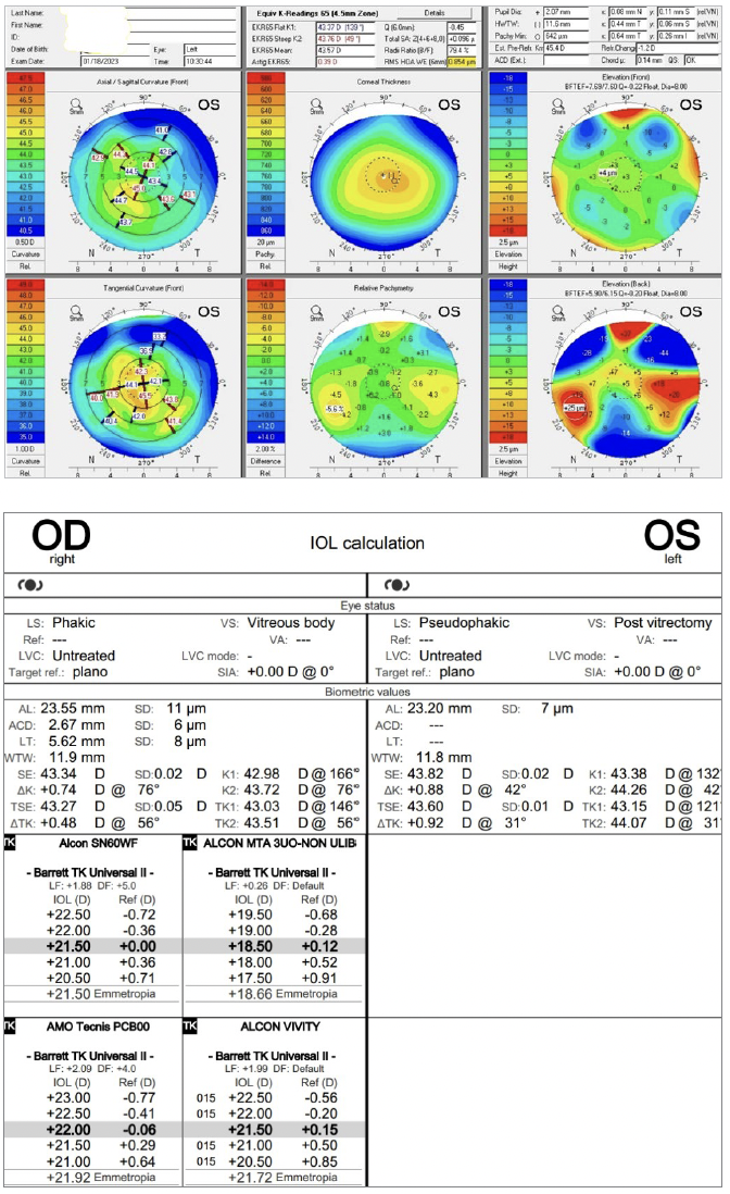 Manifest refraction table. Oculus Pentacam topography maps of the patients right and left eyes, respectively. Zeiss IOL calculation sheet.
