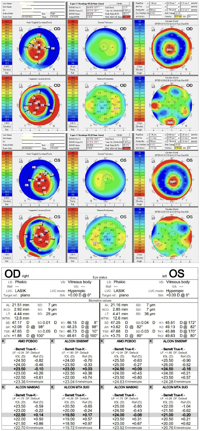 Manifest refraction table. Oculus Pentacam topography maps of the patients right and left eyes, respectively. Zeiss IOL calculation sheet.