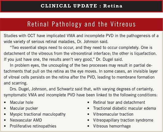 October 2012 Clinical Update Retina Web Extra