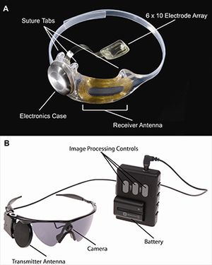 Argus II: The ‘Bionic Eye’ An Incredible Breakthrough for People with ...