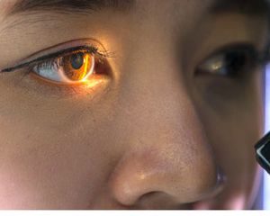 Photograph of a woman with an eye exam light in her eye