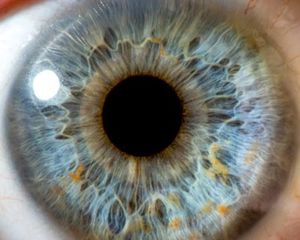 Your Blue Eyes Aren't Really Blue - American Academy of Ophthalmology
