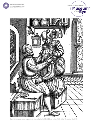 A black and white page from a coloring book. The image is a woodcutting of a 16th century doctor inserting a needle into a man's eye while a third man holds his head. All three men are wearing large, puffy, 16th century-style pants and ruff collars. They are sitting in a room with different sized jars and bottles, and a table with a long needle on it. There is a small purple logo in the upper right hand corner that reads: Truhlsen-Marmor Museum of the Eye.