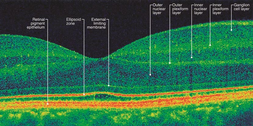 Una imagen de tomografía de coherencia óptica de una retina normal con las capas de la retina rotuladas.
