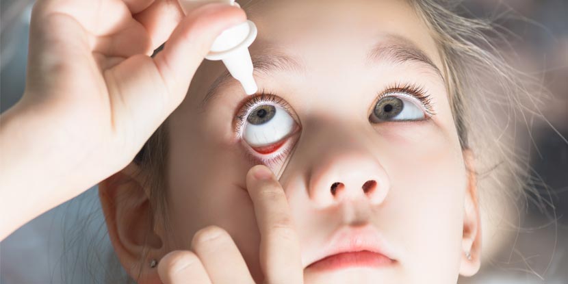 A young girl putting in eye drops to her eye.