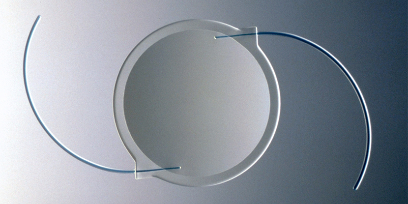 Una lente intraocular utilizada en cirugía de cataratas. Aprender sobre la operacion de cataratas.