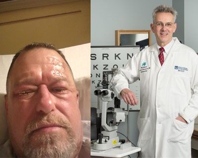 Imagen compuesta de Jeff Strayer en el hospital después del tratamiento para una quemadura química de sus ojos; y el Dr. Thomas Steinemann, el oftalmólogo que trató a Strayer y salvó su visión