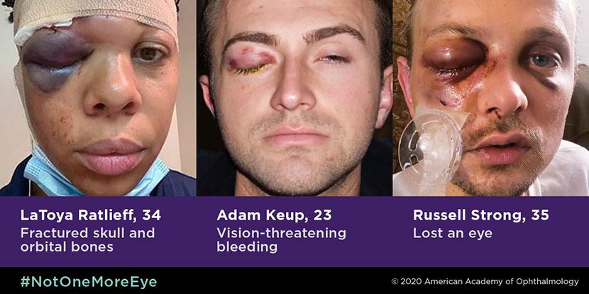 The Academy takes a stand against eye injuries from rubber bullets.