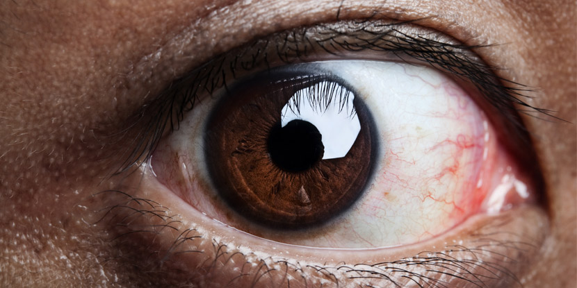 Closeup image of a brown eye.