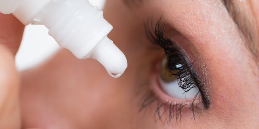 A woman holds a bottle of drops over her eye and prepares to let the drop fall into her eye.