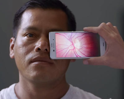 Photograph of a man getting an eye exam with a cell phone app