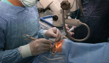 Ophthalmologist surgeon performing eye surgery on draped patient