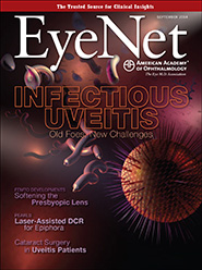 EyeNet September 2014 cover