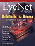 May 2013 EyeNet Cover