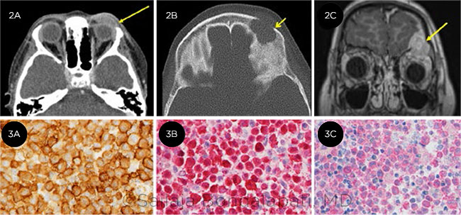 Imaging and Soft Tissue Analysis