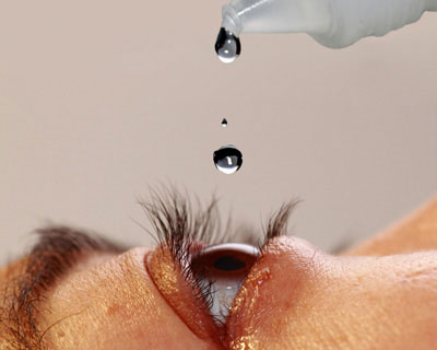 Close-up of an eye with artificial tears being dropped in