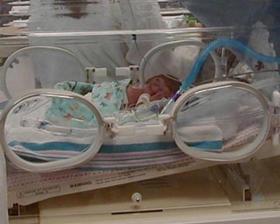 Dana, who was born premature and developed retinopathy of prematiturity, pictured in an incubator in the first months of her life.
