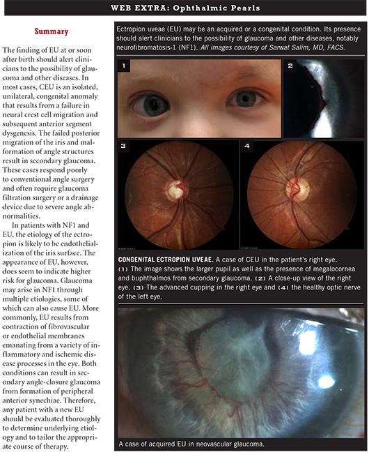 November 2013 Ophthalmic Pearls Web Extra