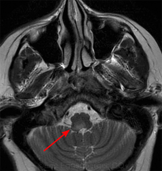 Evidence on MRI