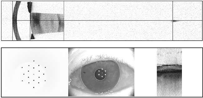 Figure 4. Optical biometry via swept-source OCT demonstrating anatomy, fixation and general anatomic landmarks of the eye.