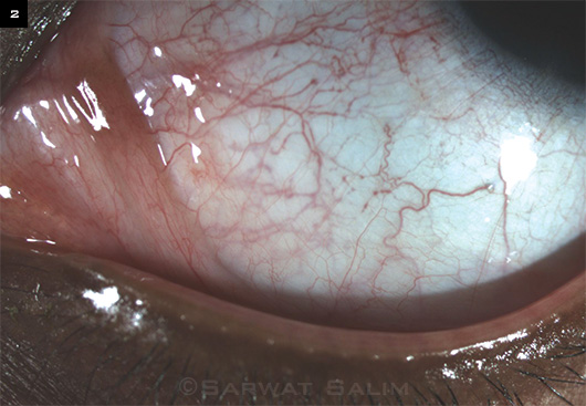 October 2014 Ophthalmic Pearls