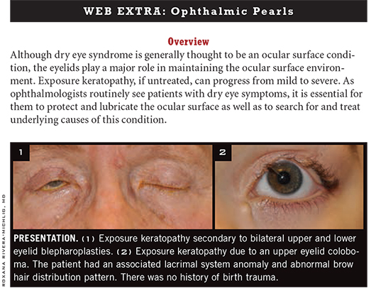 April 2014 Ophthalmic Pearls Web Extra