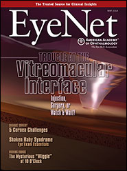 May 2014 EyeNet Cover