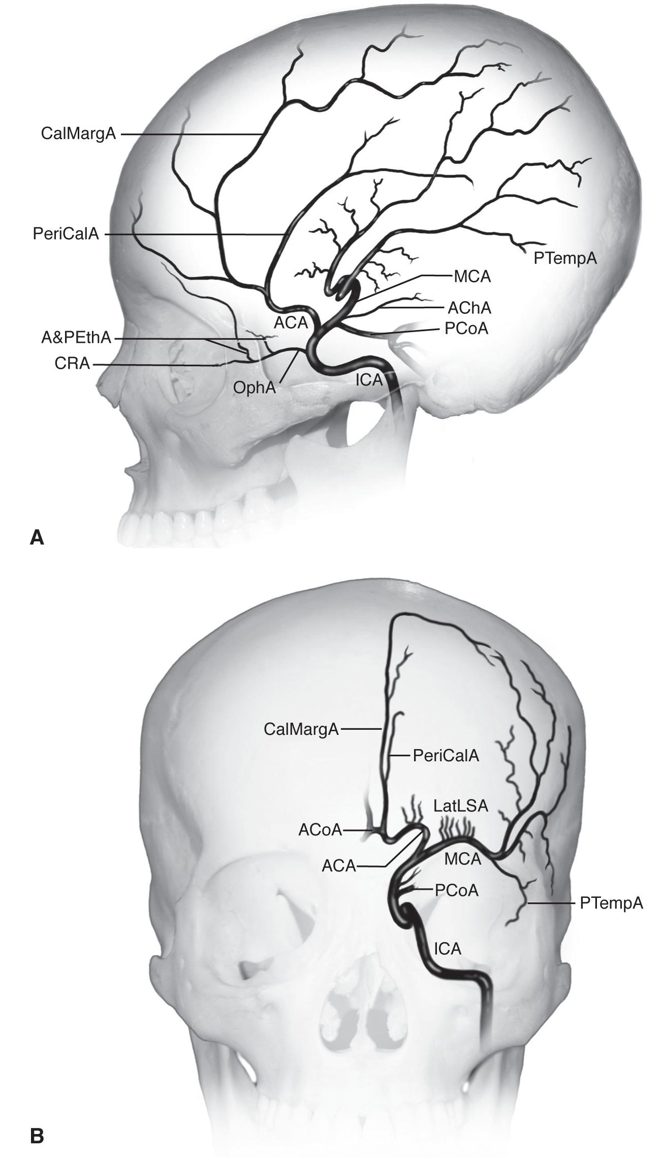 Branches of the internal carotid artery - American Academy ...