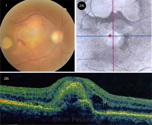What We Saw at the Retina Clinic