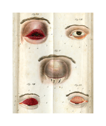 A colored illustration of five diseased human eyes. The top left eye has extremely red and swollen eyelids, but the eye remains open. The top right eye has the bottom eyelid turned outwards and it is orange. The bottom left eye has the top eyelid turned outwards and it is dark red. The bottom right eye also has the top eyelid turned outwards and it is a lighter pink. The center eye is blue and gray and is swollen completely shut.