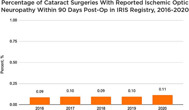 Ischemic Optic Neuropathy Following Cataract Surgery