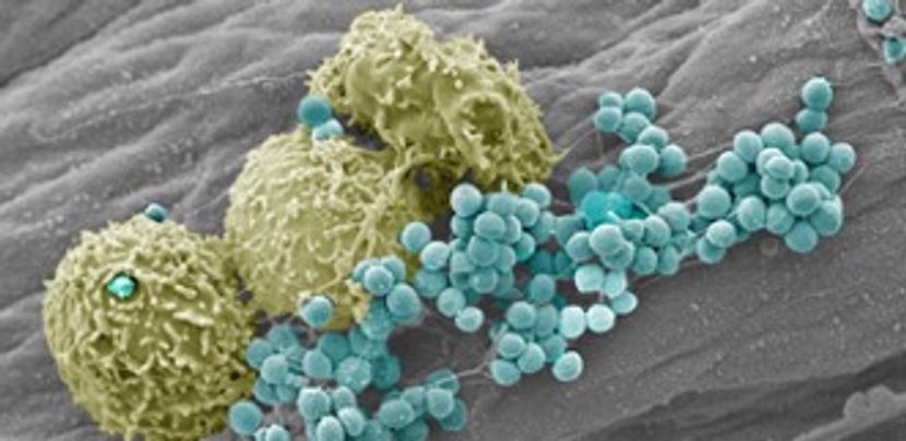 A magnified image of bacteria. There are three large circular objects that are green with a textured surface. Next to them, there are many small blue circles clumped together. They all sit on a smooth gray background.