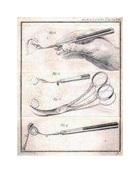 A pencil drawing of four different medical instruments. The top drawing shows a hand holding a knife with a small, flat blade and a long handle. The knife is being inserted into a drawing of a human eye. The other drawings are of two similar knives without a hand holding them and one pair of black medical scissors.