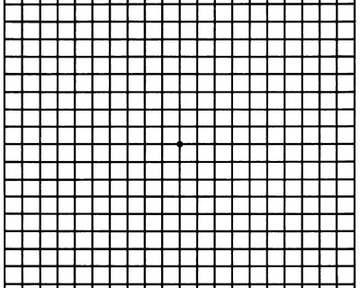 Image of an Amsler grid, which patients use to monitor progression of AMD