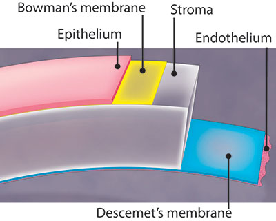 Illustration of the microscopic layers of the cornea, including Bowman's membrane. This layer is under the epithelium, which is the outermost layer of the cornea.