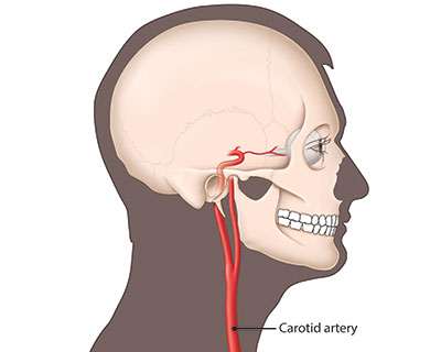 Side-view illustration of a carotid artery, which are the main blood vessels in your neck that send blood to your eyes and brain.