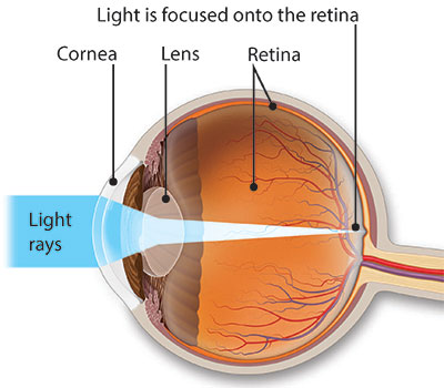 Illustration of an eye with light rays landing squarely on the retina, which means there is no refractive error.